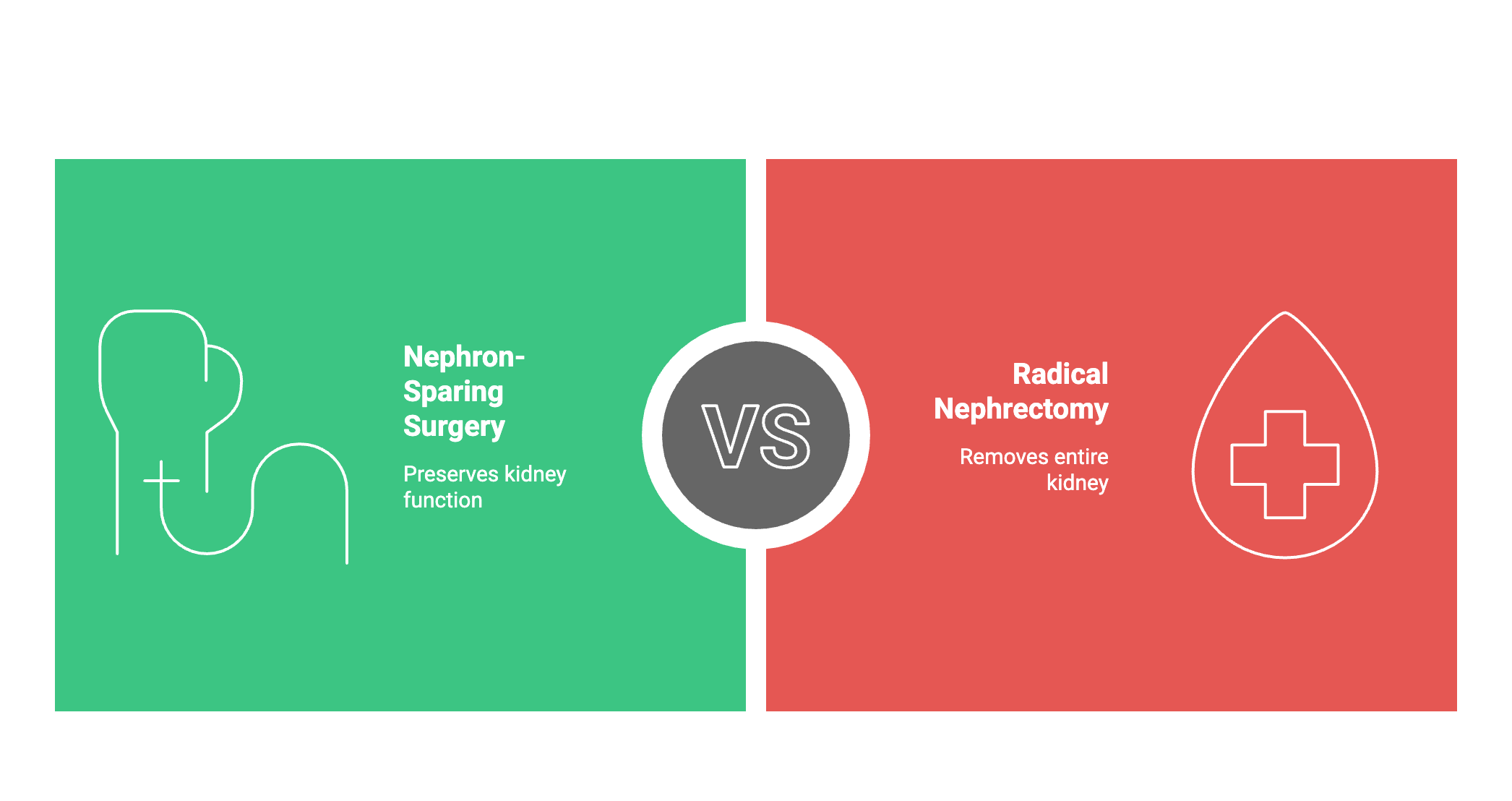Nephron-Sparing Surgery vs. Radical Nephrectomy for Kidney Cancer: What You Need to Know
