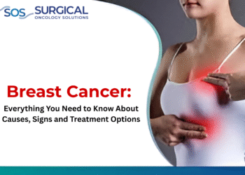 Breast Cancer: Everything You Need to Know About Causes, Signs, and Treatment Options