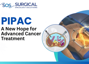 PIPAC: A New Hope for Advanced Cancer Treatment