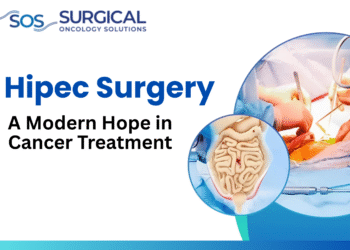HIPEC Surgery: A Modern Hope in Cancer Treatment