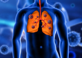 Thoracic Cancer: Types, Symptoms, Causes & Treatment