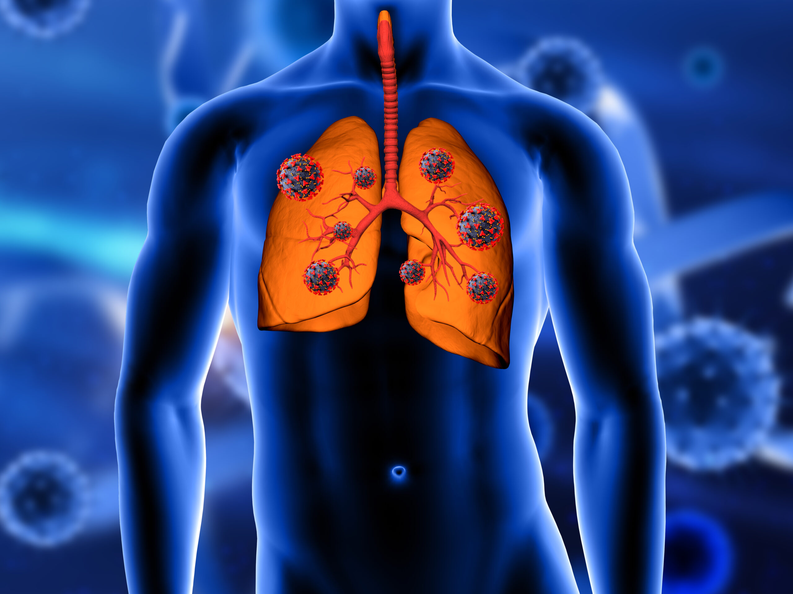 Thoracic Cancer: Types, Symptoms, Causes & Treatment