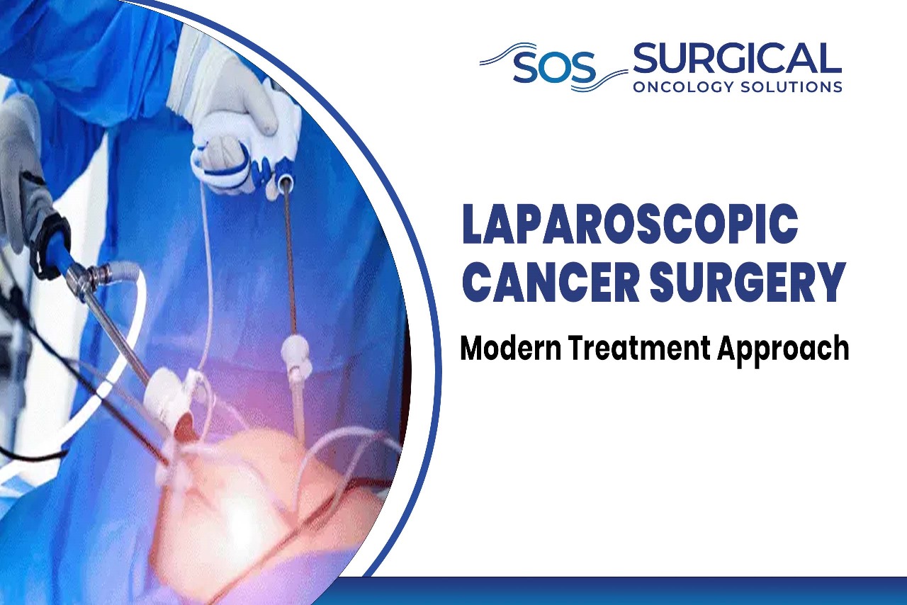 Laparoscopic Cancer Surgery: Modern Treatment Approach