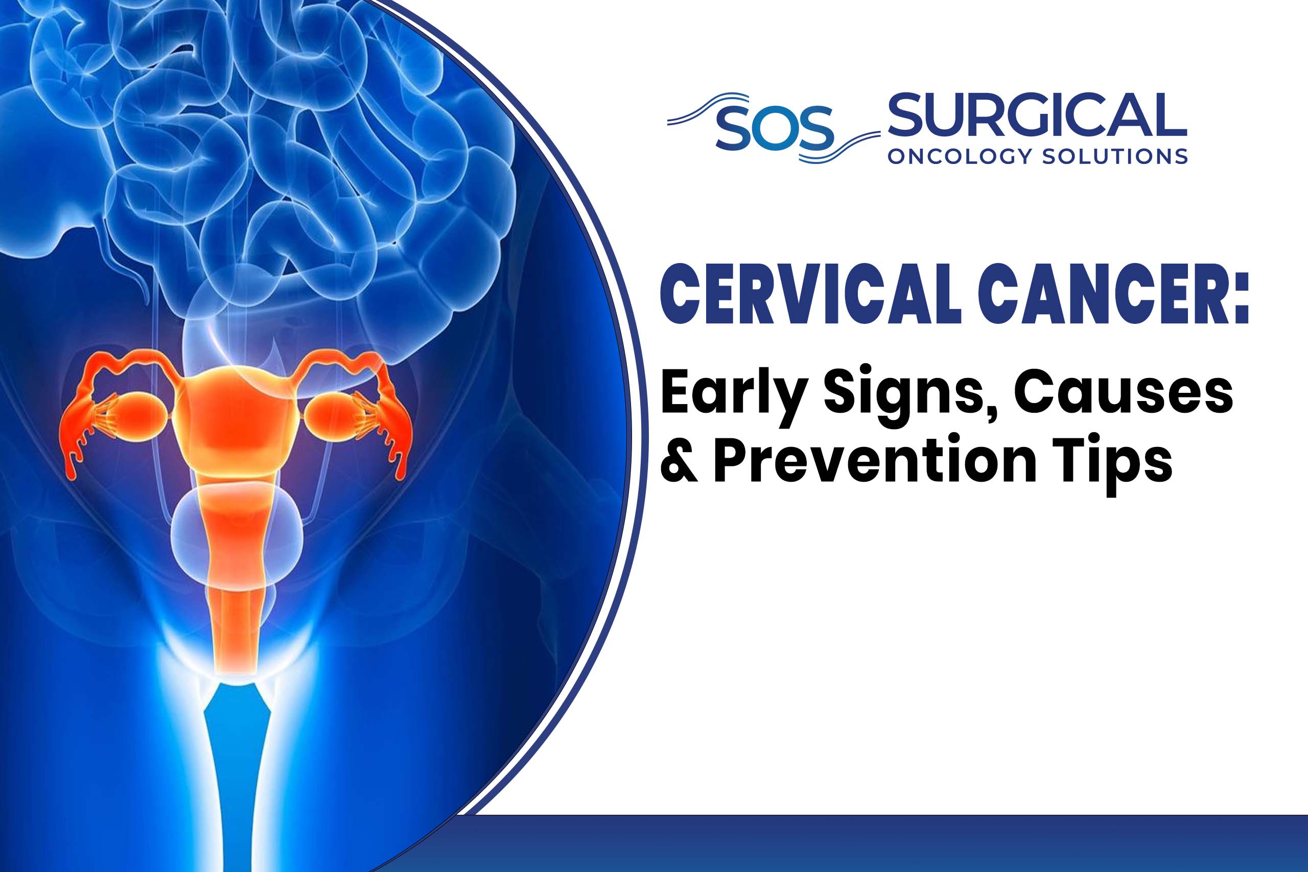 Cervical Cancer: Early Signs, Causes & Prevention Tips