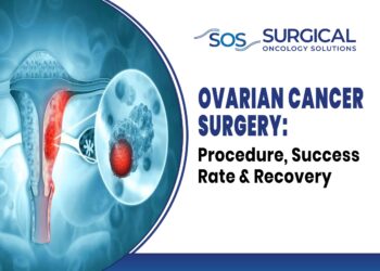 Ovarian Cancer Surgery: Procedure, Success Rate & Recovery