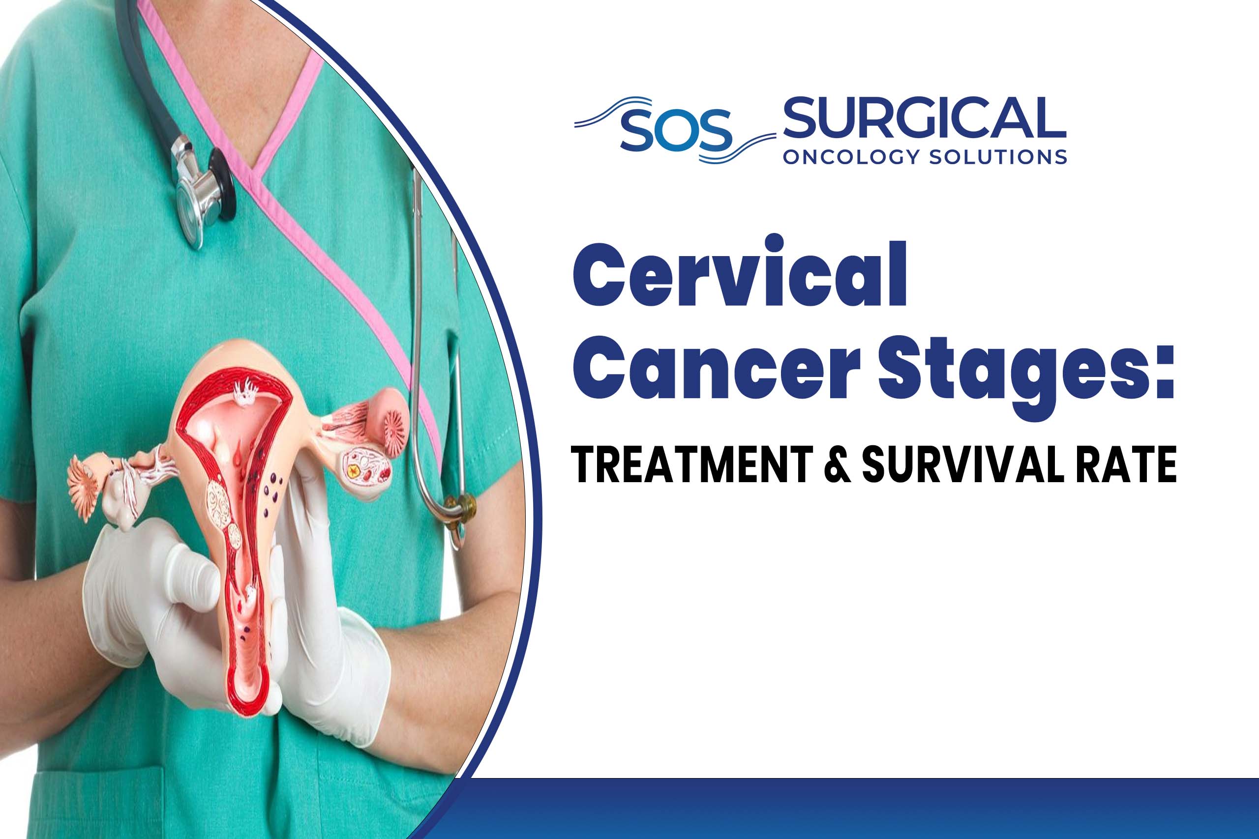 Cervical Cancer Stages: Treatment & Survival Rate