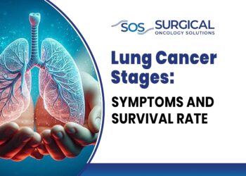 Lung Cancer Stages: Symptoms and Survival Rate