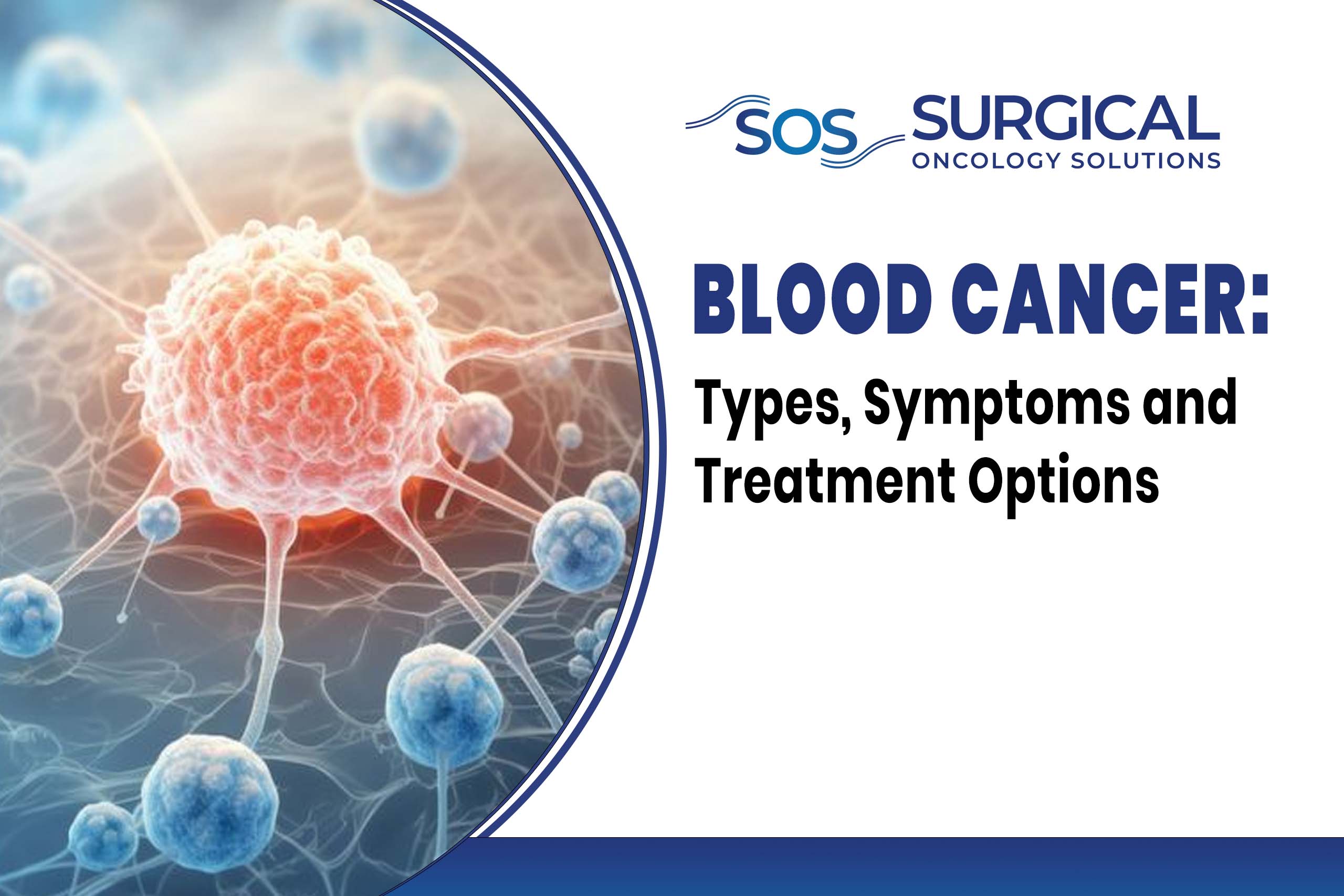 Blood Cancer: Types, Symptoms and Treatment Options
