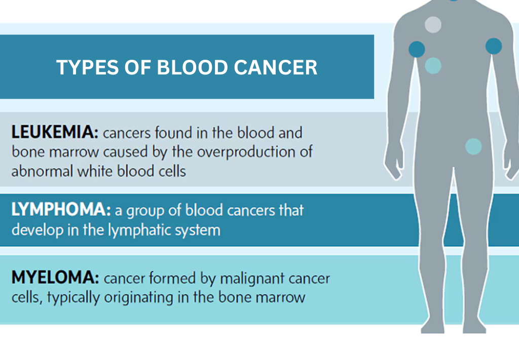 Blood Cancer: Types, Symptoms and Treatment Options