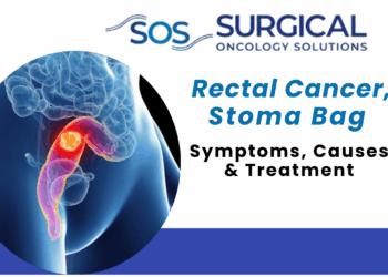 Do All Rectal Cancer Patients Need a Stoma Bag? Myths vs. Modern Reality