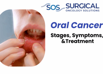Oral Cancer: Early Signs, Causes & Treatment