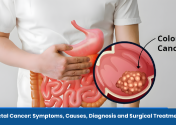 Colorectal Cancer: Symptoms, Causes, Diagnosis and Surgical Treatment